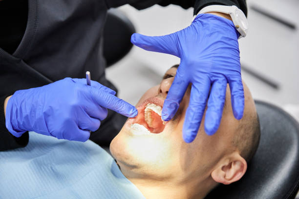 Best Emergency Root Canal Treatment in Chesterfield, MO